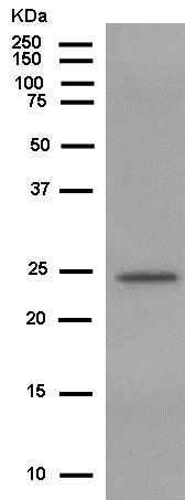 Western blot - Anti-PEX11B antibody [EPR12183] (AB181066)