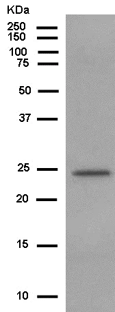 Western blot - Anti-PEX11B antibody [EPR12183] - BSA and Azide free (AB250321)