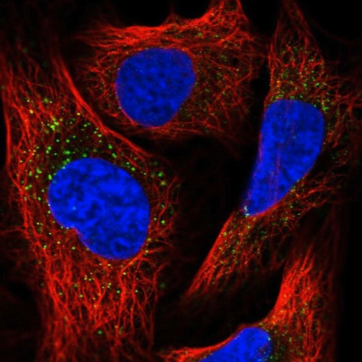 Immunocytochemistry/ Immunofluorescence - Anti-PEX13 antibody (AB204841), expandable thumbnail
