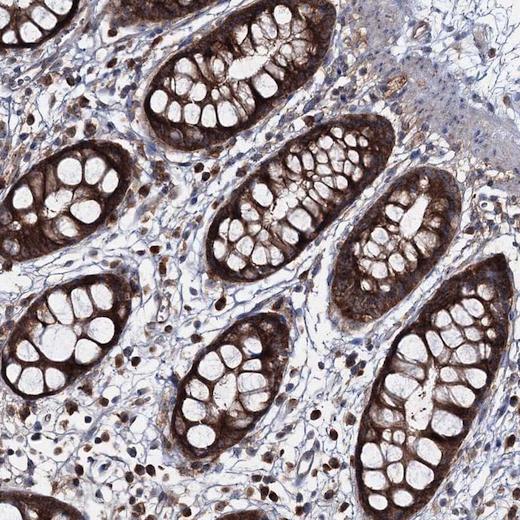 Immunohistochemistry (Formalin/PFA-fixed paraffin-embedded sections) - Anti-PEX13 antibody (AB204841), expandable thumbnail