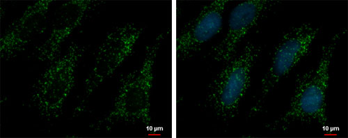 Immunocytochemistry/ Immunofluorescence - Anti-PEX14 antibody (AB183885), expandable thumbnail