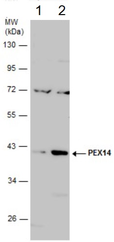 Western blot - Anti-PEX14 antibody (AB183885), expandable thumbnail