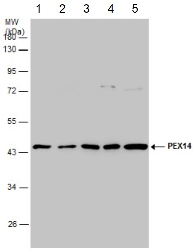 Western blot - Anti-PEX14 antibody (AB183885), expandable thumbnail