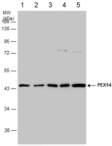 Western blot - Anti-PEX14 antibody (AB183885)