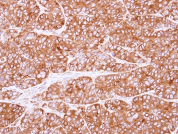 Immunohistochemistry (Formalin/PFA-fixed paraffin-embedded sections) - Anti-PEX19 antibody (AB95959), expandable thumbnail