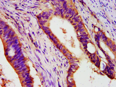 Immunohistochemistry (Formalin/PFA-fixed paraffin-embedded sections) - Anti-PEX26 antibody (AB235084)