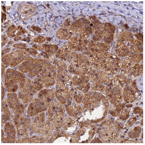 Immunohistochemistry (Formalin/PFA-fixed paraffin-embedded sections) - Anti-PEX3 antibody (ab247042), expandable thumbnail