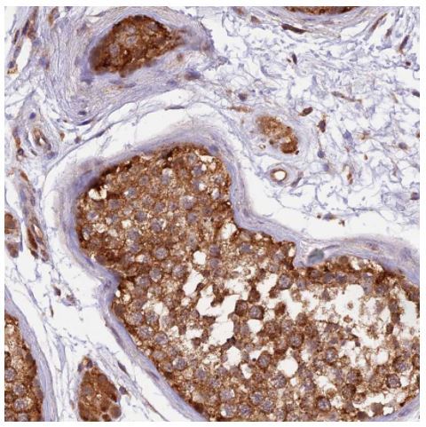 Immunohistochemistry (Formalin/PFA-fixed paraffin-embedded sections) - Anti-PEX3 antibody (AB247042), expandable thumbnail