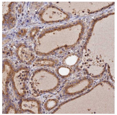 Immunohistochemistry (Formalin/PFA-fixed paraffin-embedded sections) - Anti-PEX3 antibody (AB247042), expandable thumbnail