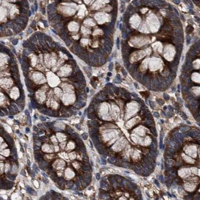 Immunohistochemistry (Formalin/PFA-fixed paraffin-embedded sections) - Anti-PEX5/PER3 antibody (AB204444)