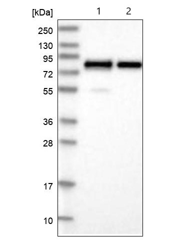 Western blot - Anti-PEX5/PER3 antibody (AB204444)