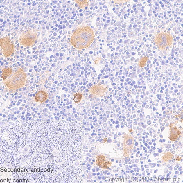 Immunohistochemistry (Formalin/PFA-fixed paraffin-embedded sections) - Anti-PF4 antibody [EPR17279-1] (AB182988)