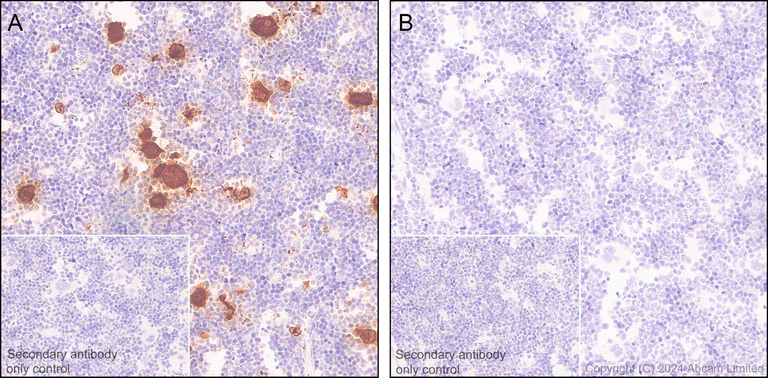 Immunohistochemistry (Formalin/PFA-fixed paraffin-embedded sections) - Anti-PF4 antibody [EPR26306-65] (AB303494)