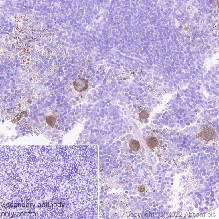 Immunohistochemistry (Formalin/PFA-fixed paraffin-embedded sections) - Anti-PF4 antibody [EPR26306-65] - BSA and Azide free (AB303495)