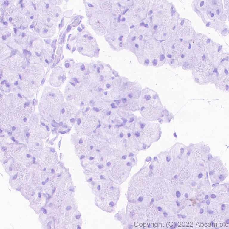 Immunohistochemistry (Formalin/PFA-fixed paraffin-embedded sections) - Anti-PF4 antibody [EPR26306-65] - BSA and Azide free (AB303495)
