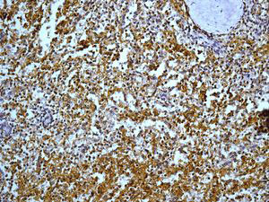 Immunohistochemistry (Formalin/PFA-fixed paraffin-embedded sections) - Anti-PF4 antibody [EPR7763] - BSA and Azide free (AB248336), expandable thumbnail