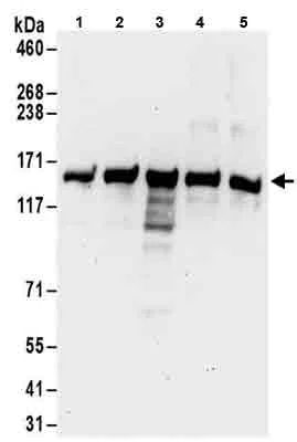 Western blot - Anti-PFAS antibody (AB186013)