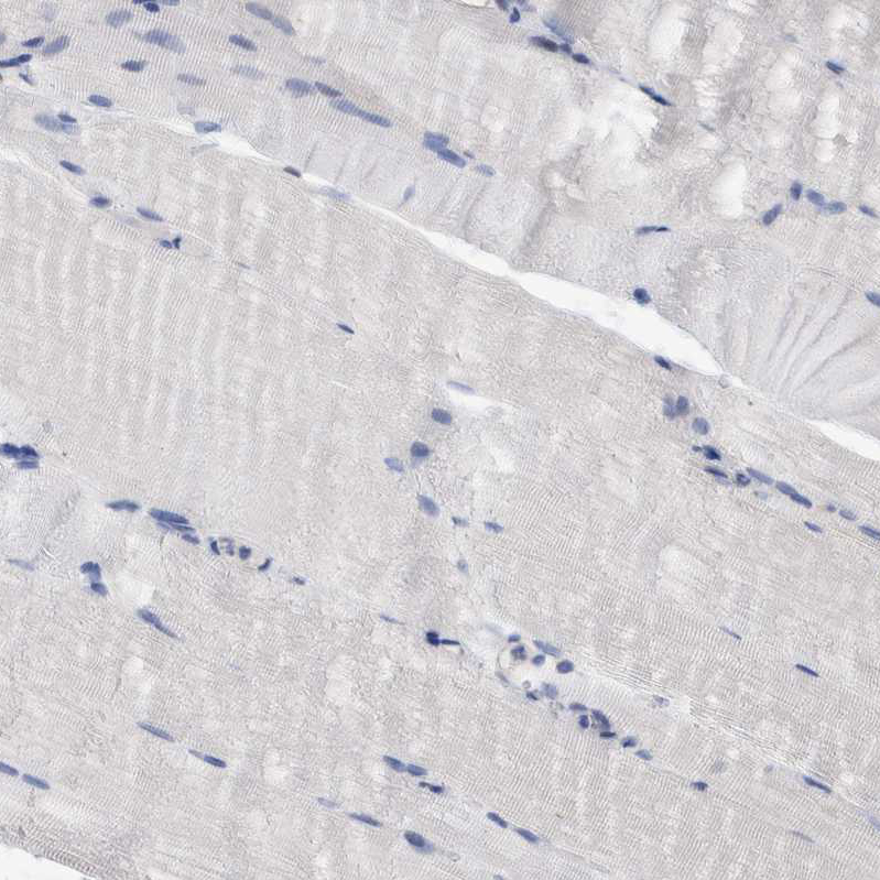 Immunohistochemistry (Formalin/PFA-fixed paraffin-embedded sections) - Anti-PFAS antibody (ab251740), expandable thumbnail