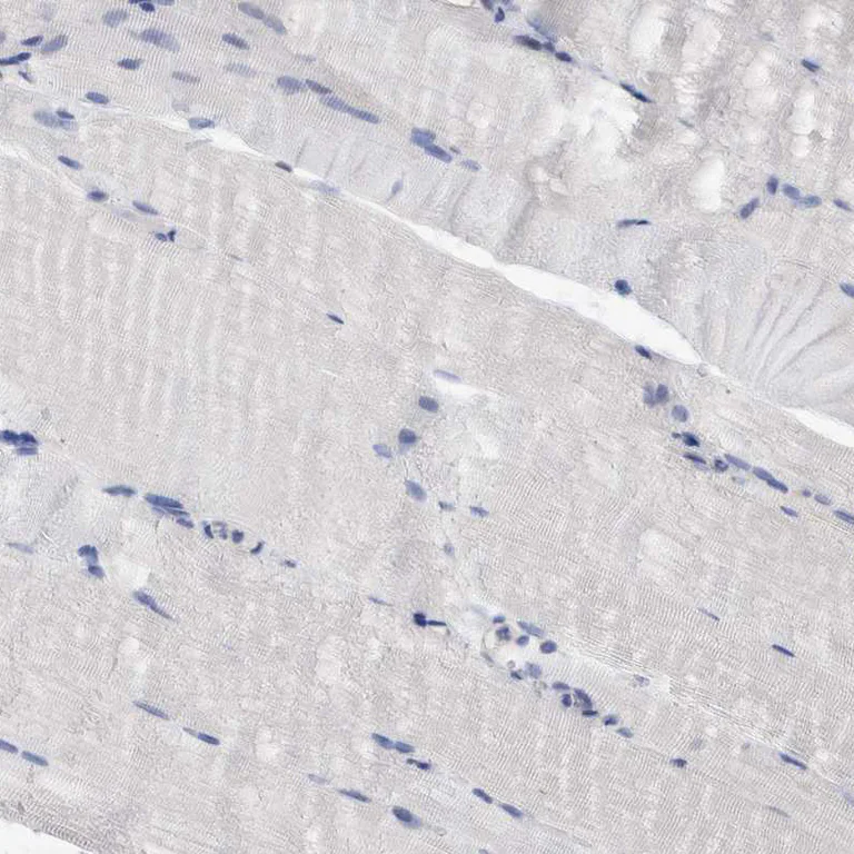 Immunohistochemistry (Formalin/PFA-fixed paraffin-embedded sections) - Anti-PFAS antibody (AB251740)