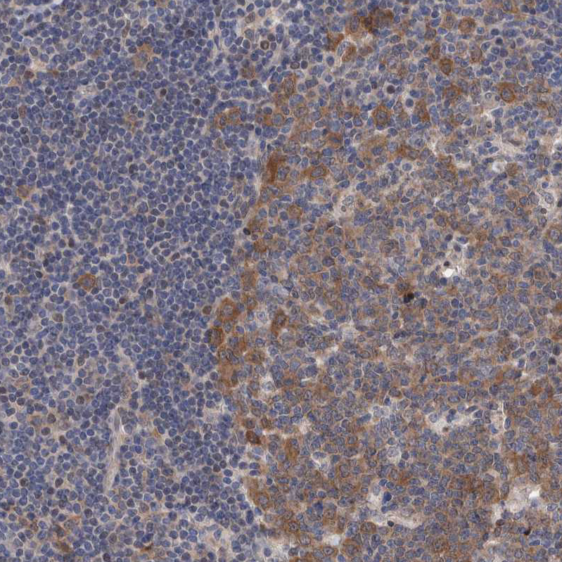 Immunohistochemistry (Formalin/PFA-fixed paraffin-embedded sections) - Anti-PFAS antibody (ab251740), expandable thumbnail