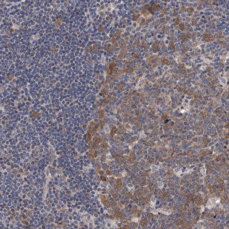 Immunohistochemistry (Formalin/PFA-fixed paraffin-embedded sections) - Anti-PFAS antibody (AB251740)