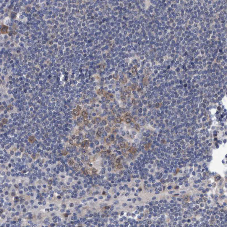 Immunohistochemistry (Formalin/PFA-fixed paraffin-embedded sections) - Anti-PFAS antibody (AB251740)
