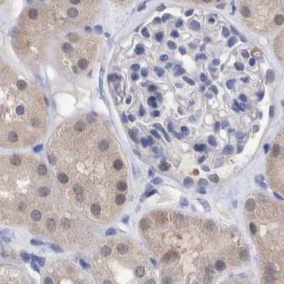 Immunohistochemistry (Formalin/PFA-fixed paraffin-embedded sections) - Anti-PFAS antibody (AB251740), expandable thumbnail