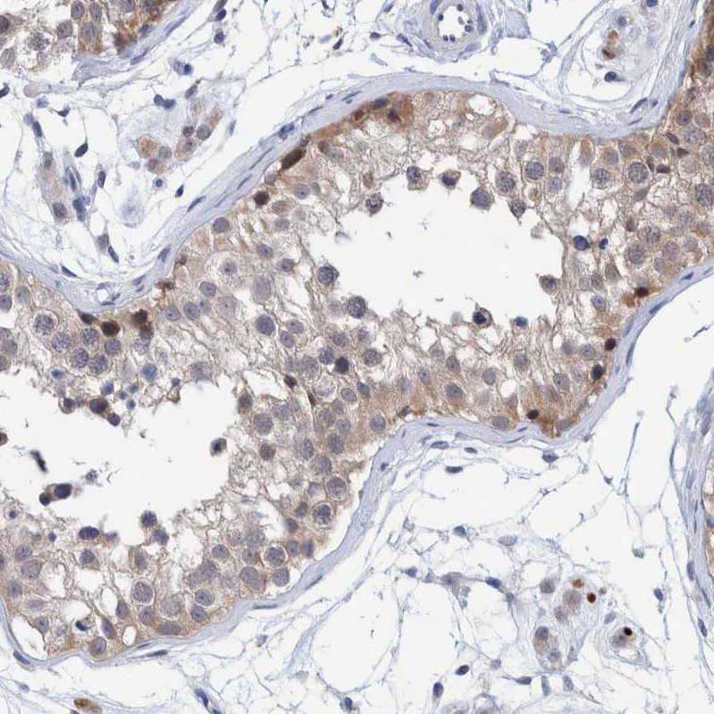 Immunohistochemistry (Formalin/PFA-fixed paraffin-embedded sections) - Anti-PFAS antibody (ab251740), expandable thumbnail