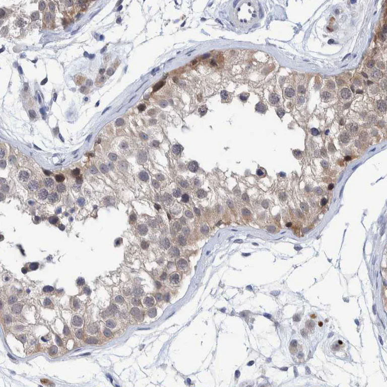 Immunohistochemistry (Formalin/PFA-fixed paraffin-embedded sections) - Anti-PFAS antibody (AB251740)