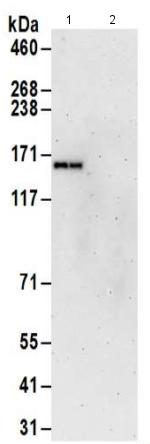 Immunoprecipitation - Anti-PFAS antibody - N-terminal (AB186048)
