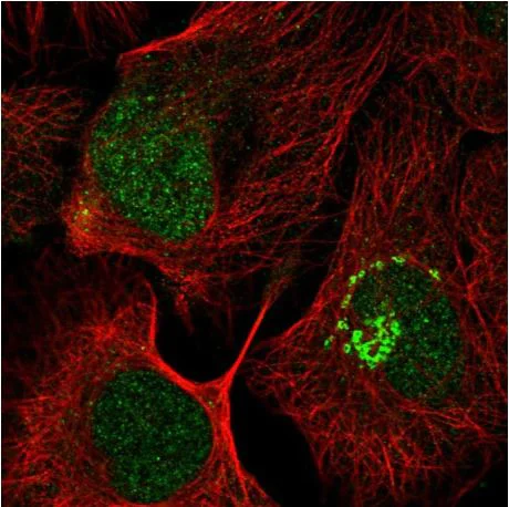 Immunocytochemistry/ Immunofluorescence - Anti-PFD6 antibody (AB184984)