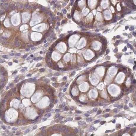 Immunohistochemistry (Formalin/PFA-fixed paraffin-embedded sections) - Anti-PFD6 antibody (AB184984)