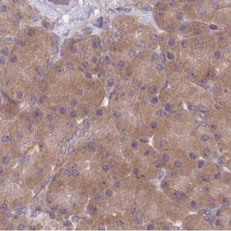 Immunohistochemistry (Formalin/PFA-fixed paraffin-embedded sections) - Anti-PFD6 antibody (AB184984)
