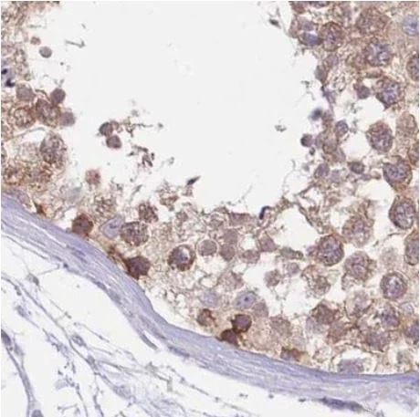 Immunohistochemistry (Formalin/PFA-fixed paraffin-embedded sections) - Anti-PFD6 antibody (AB184984)