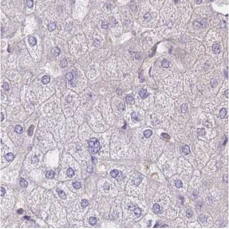 Immunohistochemistry (Formalin/PFA-fixed paraffin-embedded sections) - Anti-PFD6 antibody (AB184984)