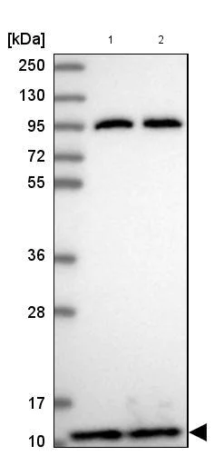 Western blot - Anti-PFD6 antibody (AB184984)