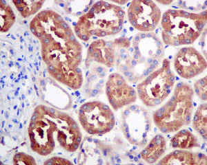 Immunohistochemistry (Formalin/PFA-fixed paraffin-embedded sections) - Anti-PFDN1 antibody [EPR8547] (AB151708)