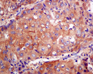 Immunohistochemistry (Formalin/PFA-fixed paraffin-embedded sections) - Anti-PFDN1 antibody [EPR8547] (AB151708), expandable thumbnail