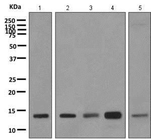 Western blot - Anti-PFDN1 antibody [EPR8547] (AB151708), expandable thumbnail