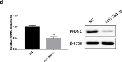 Western blot - Anti-PFDN1 antibody [EPR8547] (AB151708), expandable thumbnail