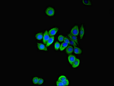 Immunocytochemistry/ Immunofluorescence - Anti-PFDN2 antibody (AB237534)