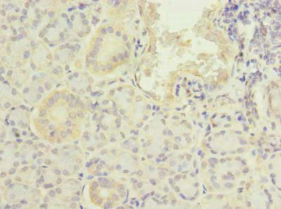 Immunohistochemistry (Formalin/PFA-fixed paraffin-embedded sections) - Anti-PFDN2 antibody (AB237534)