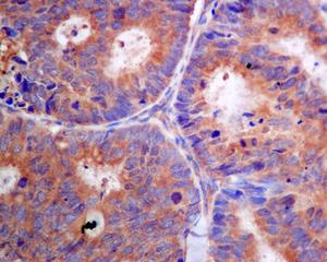 Immunohistochemistry (Formalin/PFA-fixed paraffin-embedded sections) - Anti-PFDN5 antibody [EPR7755] (AB129116)
