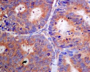 Immunohistochemistry (Formalin/PFA-fixed paraffin-embedded sections) - Anti-PFDN5 antibody [EPR7755] - BSA and Azide free (AB248313)