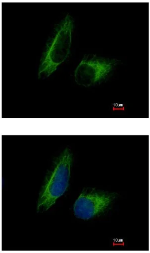 Immunocytochemistry/ Immunofluorescence - Anti-PFKFB1 antibody (AB154573)