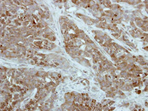 Immunohistochemistry (Formalin/PFA-fixed paraffin-embedded sections) - Anti-PFKFB1 antibody (AB154573)