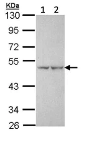 Western blot - Anti-PFKFB1 antibody (AB154573)