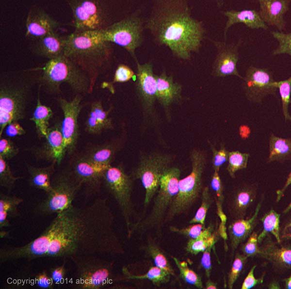 Immunocytochemistry/ Immunofluorescence - Anti-PFKFB1 antibody (AB155564)