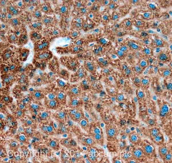 Immunohistochemistry (Formalin/PFA-fixed paraffin-embedded sections) - Anti-PFKFB1 antibody (AB155564)