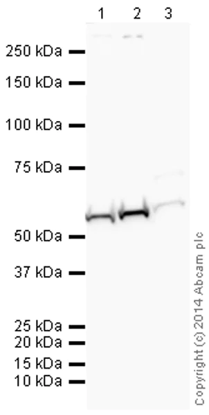Western blot - Anti-PFKFB1 antibody (AB155564)